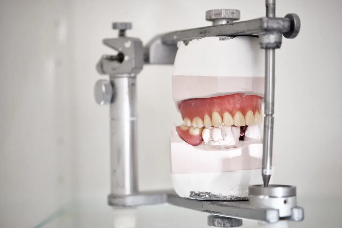 Gebitsmodel in een articulator